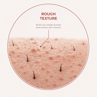 Rough Texture