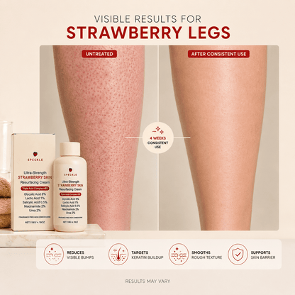 Speckle™ Advanced Triple Acid Resurfacing Complex