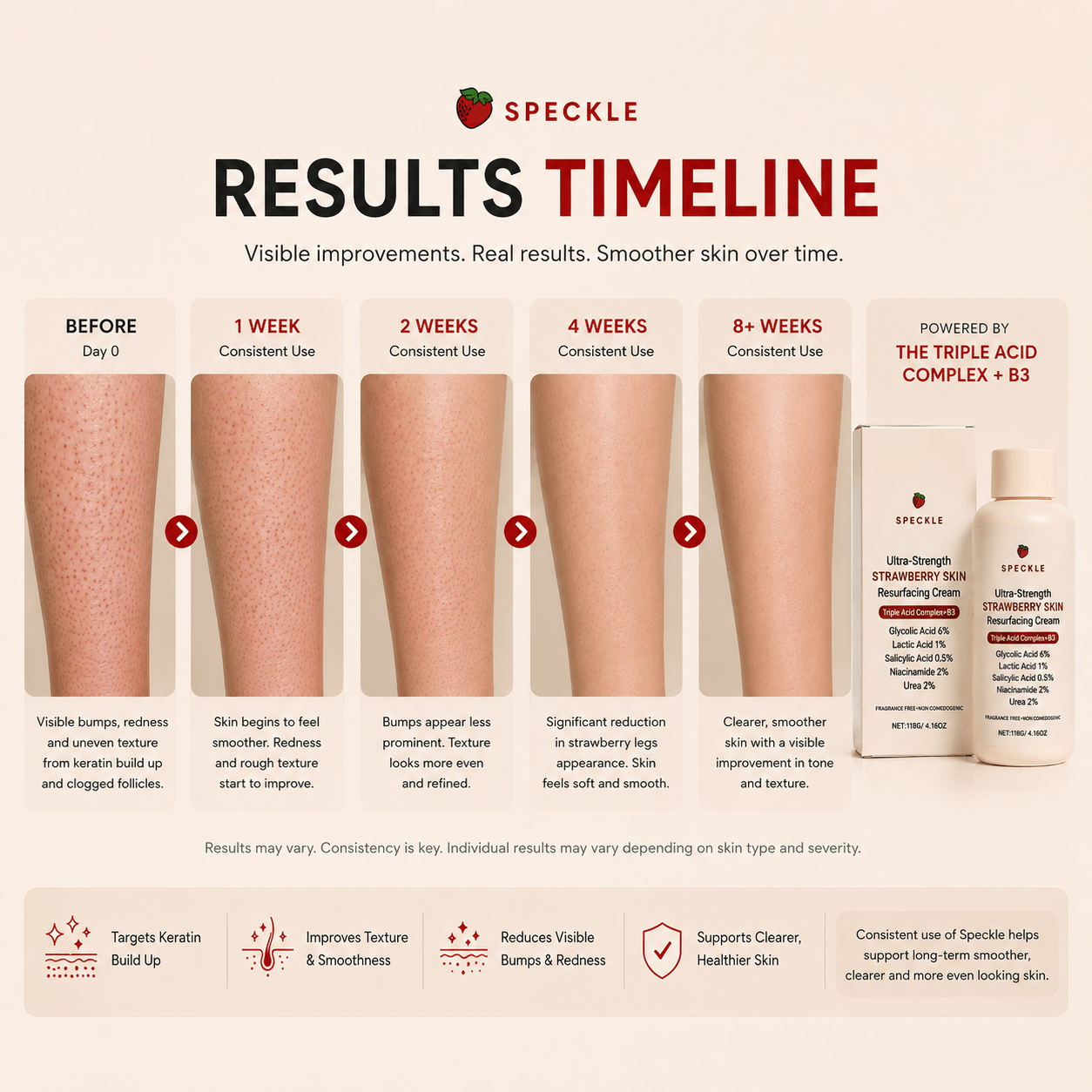 Speckle™ Advanced Triple Acid Resurfacing Complex