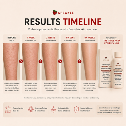 Speckle™ Advanced Triple Acid Resurfacing Complex